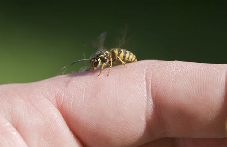 home-remedies-for-wasp-sting